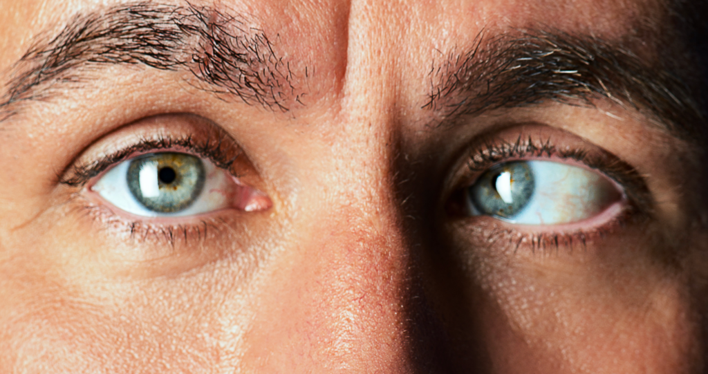 Strabismus (crossed eyes) – Cypress Eye Centre