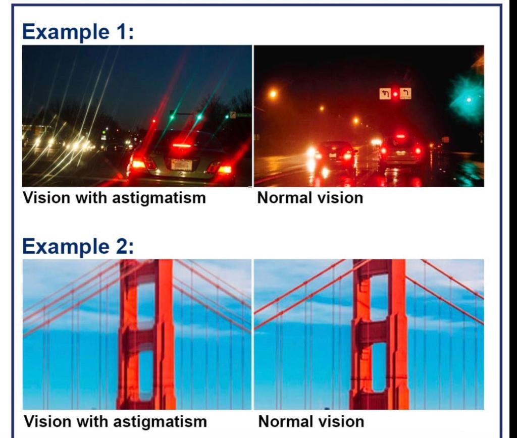 person with astigmatism